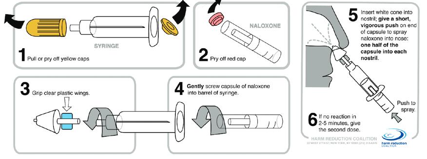 Spray half (1 ml) of naloxone in one nostril and the other half (1 ml) in the other Repeat if there is no response after three minutes Single-Step Intranasal Naloxone: Peel back the package to remove