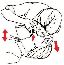 Rescue Breathing Step by Step Step 4: Pinch the person s nose closed completely.