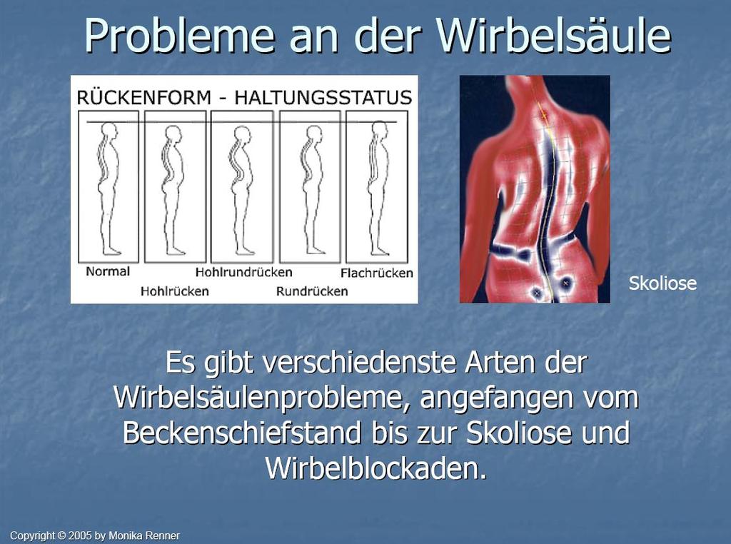 Problems of the spine vertebra.