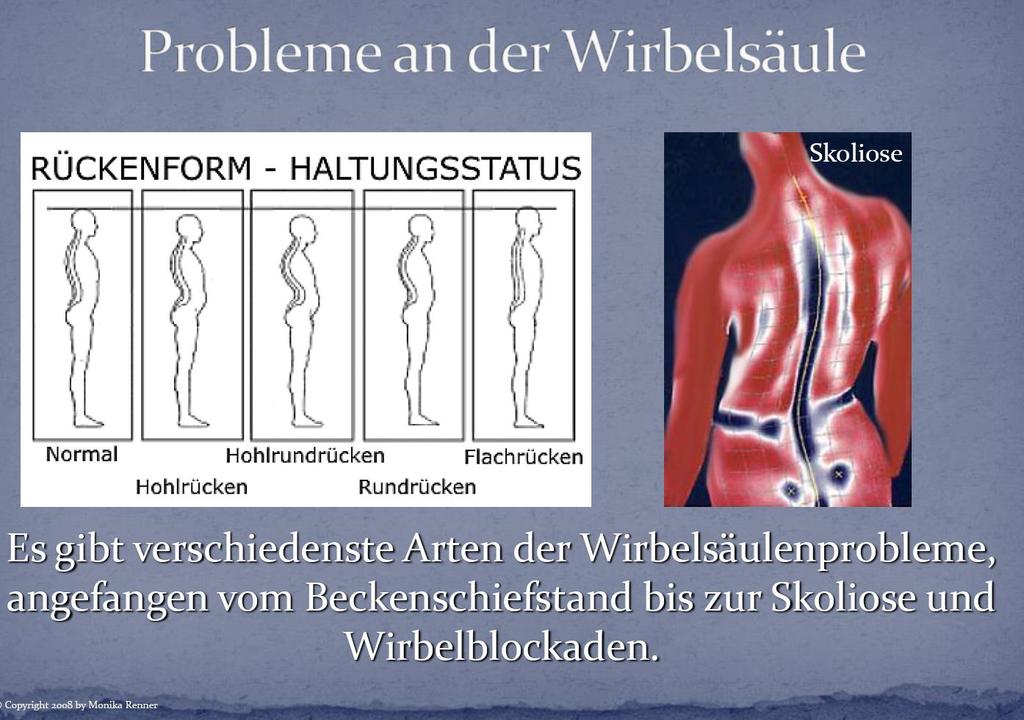 Problems at the spine vertebra.
