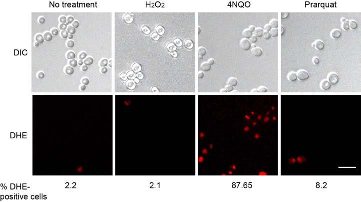 Supplementary Figure 5. 4NQO and Paraquat, but not H 2 O 2 increase cellular superoxide WT yeast cells were treated with 0.4 mm H 2 O 2, 5 µg/ml 4NQO or 1 mm Paraquat for 20 min.