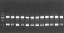 All the obtined PCR products hd the sme cdna sequences s the gene bnk sequences (dt not shown). The degree of VEGF mrna by semiquntittive RT-PCR ws 0.0538±0.0165 in the therpy group, nd 0.7373±0.