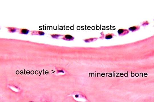 and endosteum osteoblasts Osteoblasts Bone forming cells (a) Osteogenic cell