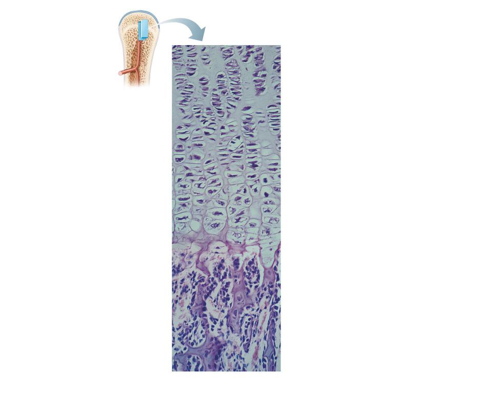 When completed, hyaline remains only in the epiphyseal plates and articular s. Figure 6.