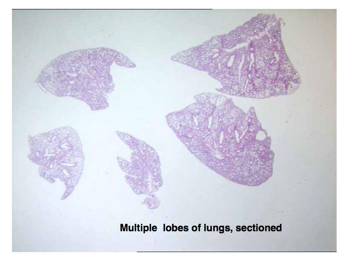 Separate out each of the mouse lung lobes and