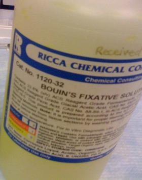 fixation requires special processing Bouin s fixative is quick but it hardens