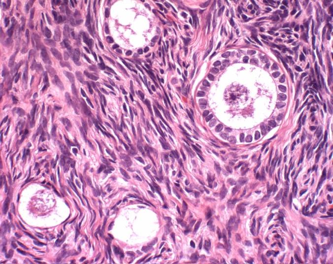 Ovary with developing follicles Cuboidal