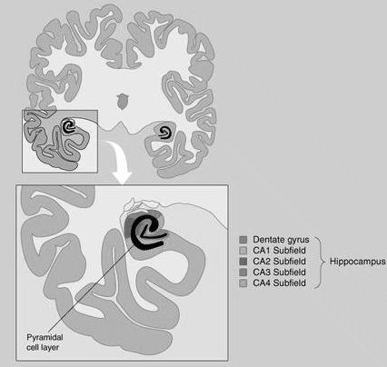 : damage to CA1 area of hpc (very selective) Zola-Morgan, Squire, & Amaral, 1986 medial diencephalic