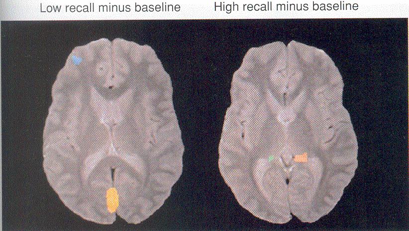 Imaging the human brain and memory /Perceptual priming and implicit and explicit memory (1/2) Experiment Schacter et al.