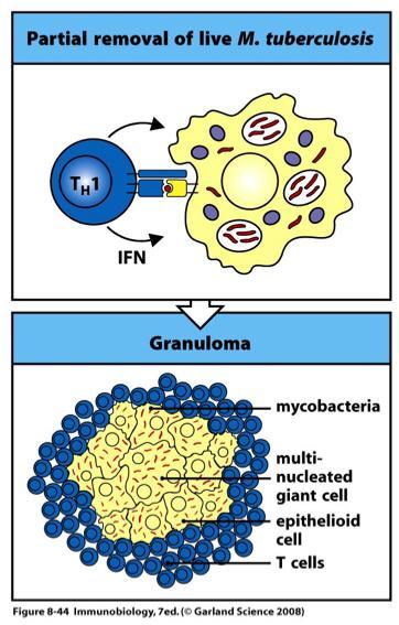 Some pathogens can resist the effects of macrophage activation Granulomas form when an intracellular pathogen such
