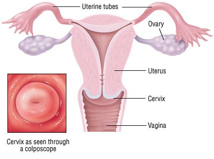 What is cervical cancer? The cervix is the bottom part, or neck, of the uterus.