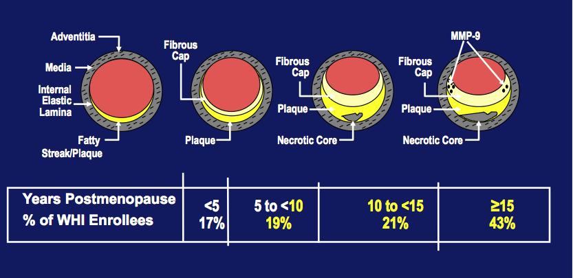 Progression of atherosclerosis by age in