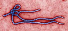 Ebola Virus Virology Filovirus (filamentous shape) Lipid-enveloped, large Virus