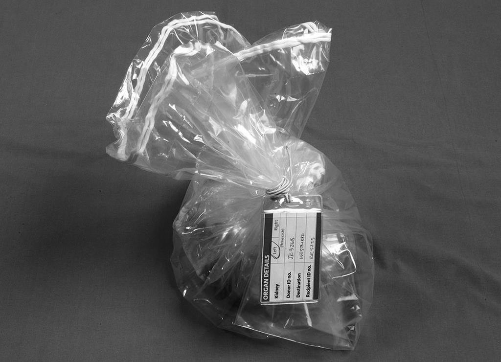 Inner bag placed in 2nd bowel bag (middle bag) containing 300-500ml cold sterile normal saline solution. 3. Middle bag placed in 3rd bowel bag (outer bag).