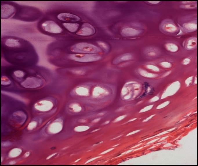 2. A B a) Which type(s) of growth occurs in this tissue? (1 mark) b) Identify A.