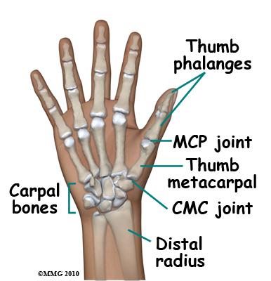 Adult Thumb Metacarpal Fractures Anatomy The metacarpals are the five bones of the hand that connect the carpal bones (wrist) to the proximal phalanges (fingers).