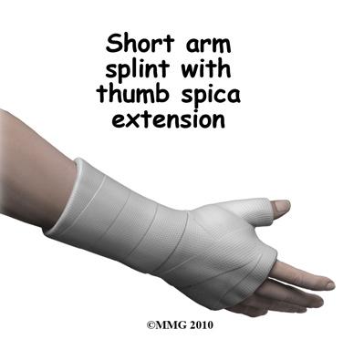reduced (or manipulated) to a stable alignment without surgery and held with a cast or brace until it heals or 3) surgery will be necessary to align the fracture fragments and fix the fragments with