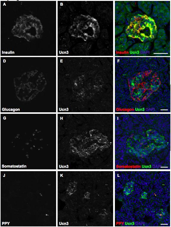 Figure 3-5. Ucn3 expression in human pancreas (A-C) Confocal images showing immunostaining of Ucn3 (green) and insulin (red) on pancreatic sections from an adult human.