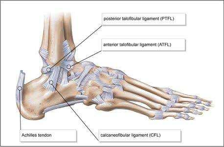 Lateral ligament injury Grade 1-3 RICE