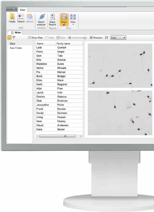 Vision Sperm Integro Automatic sperm quality analysis and sperm microscopy in one system An integrated system for conducting sperm quality