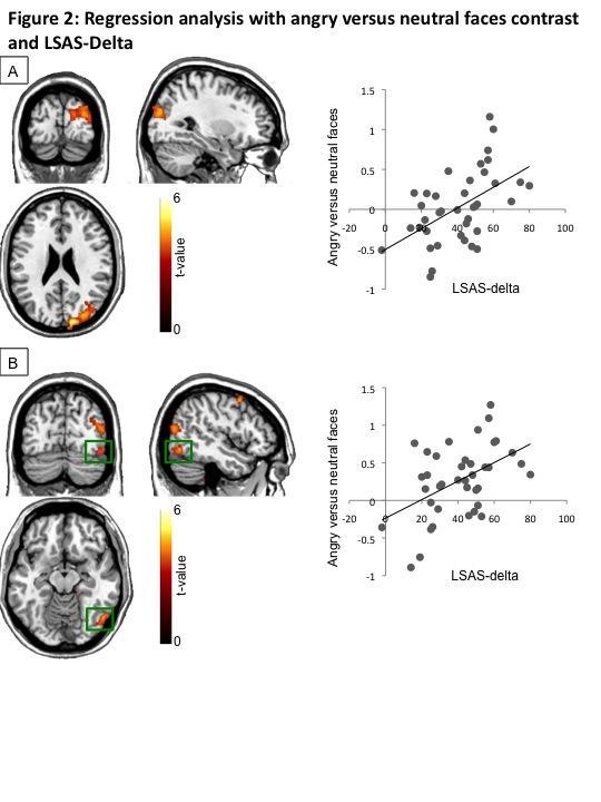 LSAS change associated with activation in dorsal occipital cluster