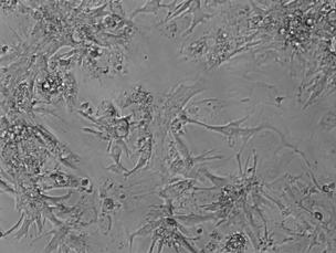 immunofluorescent technologies, primary cardiomyocytes is olated and cultured with the Pierce Primary Cardiomyocyte Isolation Kit are well-suited for experiments aimed at visualizing cellular