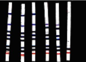 INNO-LiPA RifTB Hybridization Rifampicin resistant MTB strains M.Flavescence Fig. Representative INNO LiPA results for the rifampicin resistant strains of M. tuberculosis.