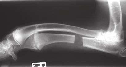 Elbow incongruity may be evidenced by radial bowing and external rotation of the elbow or carpus joint in the affected limb as well as by partial elbow dislocation 3,4 (FIGURE 9).