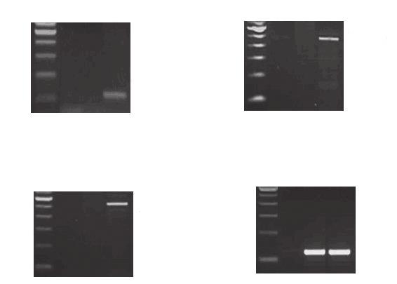 Molecular diagnosis of cerebral toxoplasmosis by PCR fold in the genome of T. gondii.