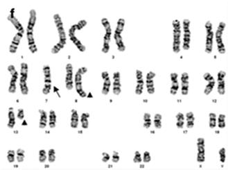 specific markers Cytogenetics Chromosome analysis FISH Targeting specific chromosomes Molecular studies