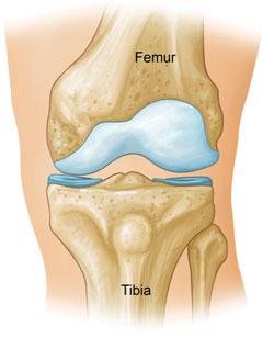 The pain may often cause a feeling of weakness in the knee, resulting in a "locking" or "buckling." Many people report that changes in the weather also affect the degree of pain from arthritis.