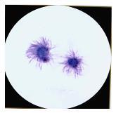 Megakaryocytes/hematopoiesis in EMH Detached ciliary tufts Normal, physiologic phenomenon.
