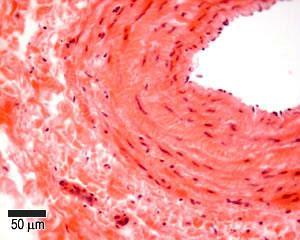Muscular veins You can identify the three layers,1- tunica intima (thin flattened endothelial cells), 2- the thick muscular tunica media and 3- the adventitia layer, which has vasa vasorum.