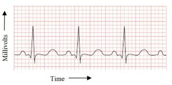 ELECTRICAL ACTIVITY OF THE HEART - THE ELECTROCARDIOGRAM As noted above, the cardiac muscle of the heart contracts in response to electrical signals which are generated by the sinoatrial node,