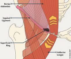 unknown ; some proposed underlying pathologies are: Bulging of the posterior wall bulging causing entrapment