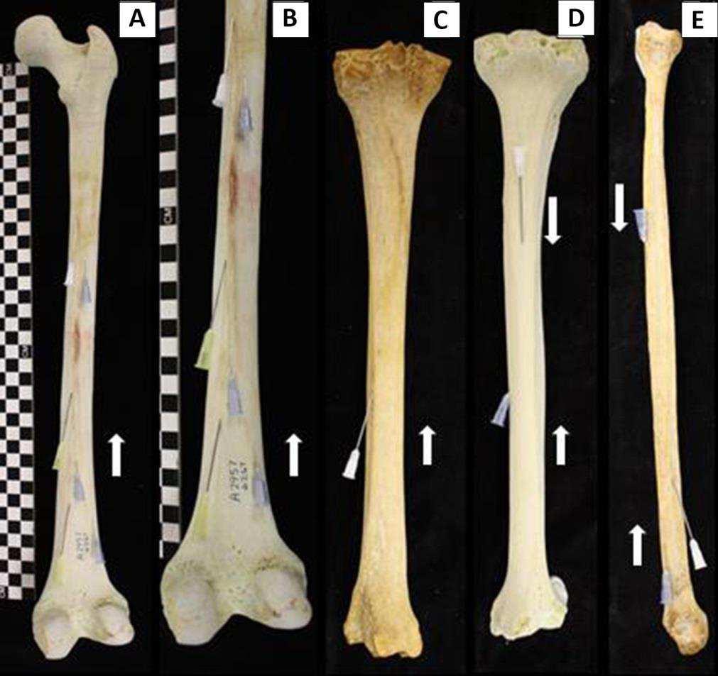P. Mazengenya and M.D. Fasemore Table 1. The mean length (cm) of the lower limb long bones in black and white South Africans Bone Mean length R L R L Mean R L R L Mean Femur 45.74 45.90 42.50 42.
