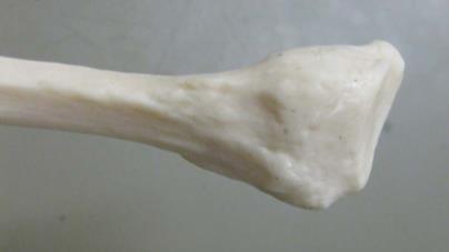 Lateral malleolus 9.