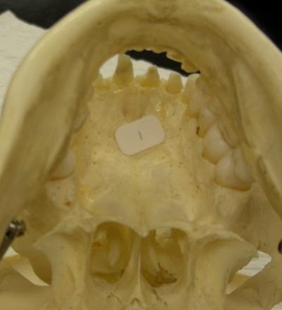 Bone Flashcards for 0a Maxilla. Infraorbital foramen 0. Other skull bones:. Zygomatic bones (has temporal process).