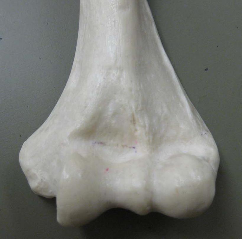 Right or left?. Medial epicondyle 6. Coronoid fossa.