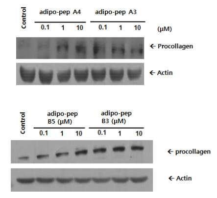 2. The activated expression of Procollagen Type-1 in fibroblasts - Adiponin