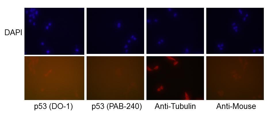 Native or un-denatured p53 protein was detected in HCC70 cells with the p53 (DO-1) antibody, however native p53 protein was not detected with the p53 (PAB-240) antibody.