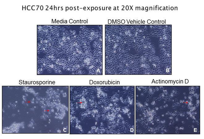 Figure 2: Immunofluorescence Images of HCC70 Cells. Figure 3 displays the immunofluorescence of native p53 protein expression in HCC1806 cell lines.