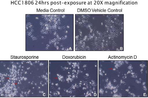 Figure 4: Light Microscopy of HCC70 Cell Line Death Response to Chemotherapeutics 24hr Post-Exposure.
