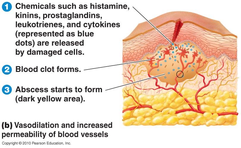 Stages of Inflammation Histamine release from