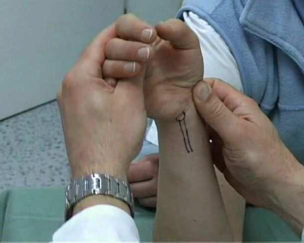 Testy pre posúdenie stability SL väzu Scaphoid Shift Test - Watsonov test Štyri prsty jednej ruky sa položia na dorsum rádia a palec tej istej ruky na tuberositas ossis scaphoidei.