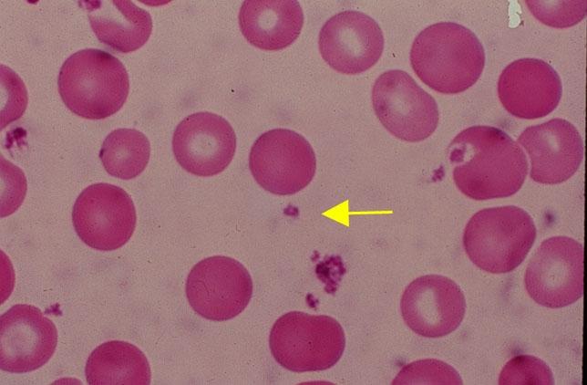 Platelets (Thrombocytes) *