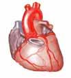 Circulatory Disorders (390-459) Acute subendocardial MI, following hospital stay Arteriosclerotic heart disease (ASHD) Arteriosclerotic