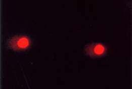 cells Irradiated cells treated with GP4G The comet assay is a very sensitive method to