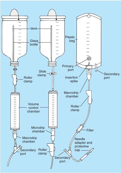 Intravenous Infusion Set Includes: Sealed bottle or bag Tubing Drip chamber connected by small tube or spike Tubing leading from drip chamber to needle or catheter Clamp to adjust flow