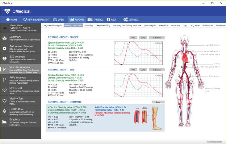 COMPREHENSIVE NON INVASIVE SYSTEM INCLUDES: Comprehensive Autonomic Balance Analysis (ANS) Arterial Vascular Assessment Ankle Brachial Index (ABI) Cardiovascular Fitness Cumulative Mental and